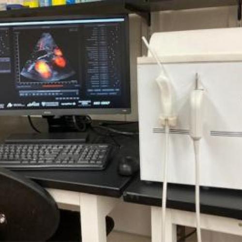 Ultrasound Machine