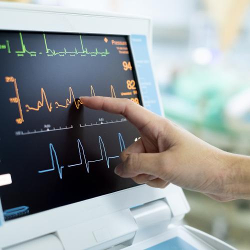 A healthcare worker touches and EKG screen