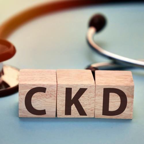 Three wooden blocks spell CKD